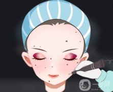 如何護理激光點痣后的凹洞？激光點痣后要忌口多久？