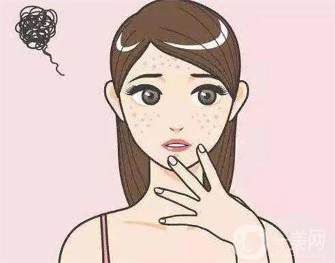 去老年斑的方法都有哪些呢 哪種比較好？