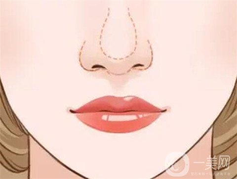 徐州二院整形美容科價(jià)格表，附隆鼻整形案例