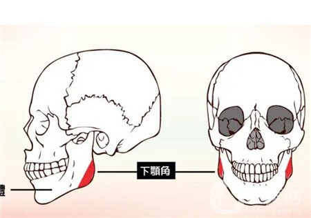 磨骨手術(shù)照片 磨骨*果怎么樣？