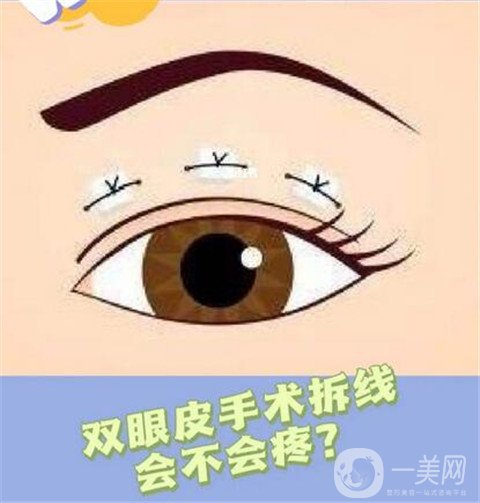 寧波市第一醫(yī)院整形美容科割雙眼皮怎么樣？價格表及案例詳情