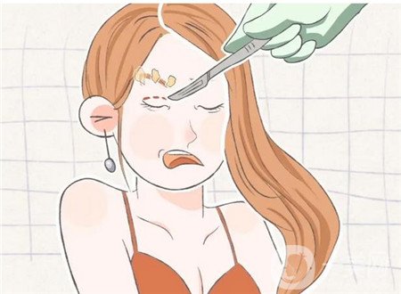濟南隅美整形醫(yī)院怎么樣?雙眼皮真實案例和價格表一覽