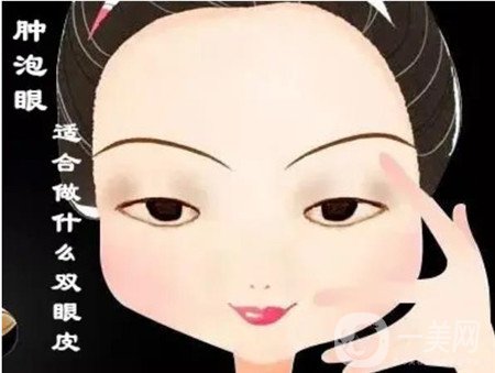 北京處靳小雷怎么預(yù)約？雙眼皮修復(fù)案例及整形價格表