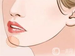 墊下巴多久才能完全恢復(fù)？怎么保養(yǎng)