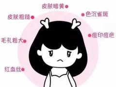 用深藍射頻去除黑眼圈嗎？有嗎？