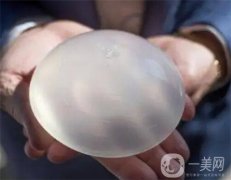 娜高乳胸假體怎么樣？好不好？哪些人不適合