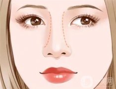隆鼻為什么會(huì)穿孔？微創(chuàng)隆鼻危險(xiǎn)嗎？