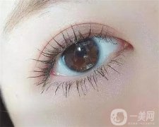眼袋手術(shù)后需要多長時間恢復？