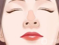 鼻小柱延長怎么修復?怎么護理?