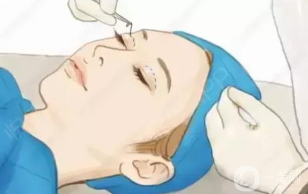 吸脂去下眼瞼眼袋價格是多少？