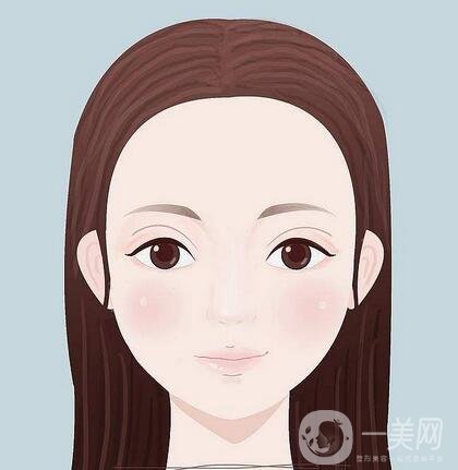 開(kāi)內(nèi)眼角