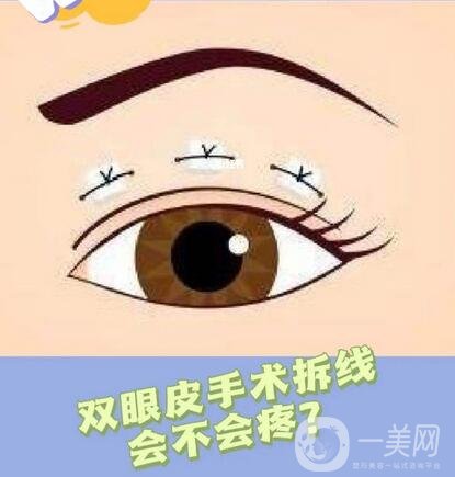 韓式*開眼角,價格
