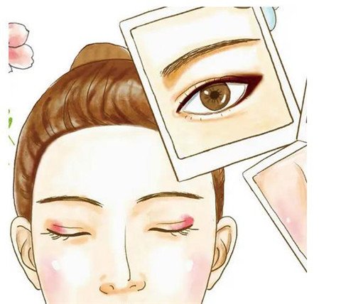 割雙眼皮疼嗎？有多疼？