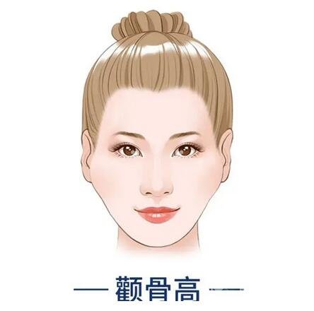 顴骨內(nèi)推注意事項詳情介紹
