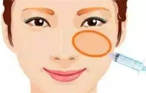 一針*能打兩邊嗎？