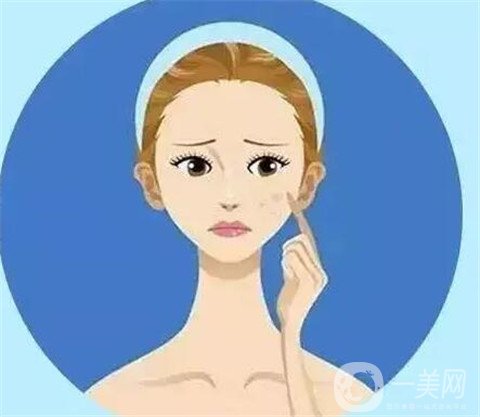 去痣的費(fèi)用大概是多少錢？