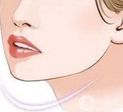 玻尿酸填充下巴有什么副作用嗎？