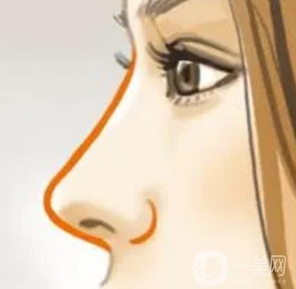 南京醫(yī)科大學(xué)友誼醫(yī)院整形外科價(jià)格表，附隆鼻案例圖