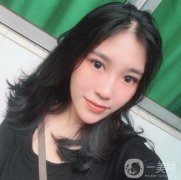 我做的是硅膠假體墊下巴，我選擇的假體也是一款進(jìn)口的假體