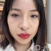 眼袋的形成讓我脾氣變得暴躁起來，父母說我是因為通宵或者是愛哭才發(fā)生的