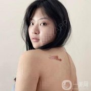 對(duì)于我們這種身上有疤的人來說，每一塊地方都是一個(gè)特別痛苦的回憶