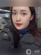 大家都讓我出一期熱瑪吉的視頻，但是我還沒(méi)有做過(guò)熱瑪吉的手術(shù)