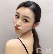 除皺:面診的時(shí)候，醫(yī)生也是的專業(yè)，說(shuō)出了本人的問(wèn)題，結(jié)合問(wèn)題做出了方案