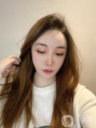 注射完了玻尿酸以后，我的臉有一些腫脹感，但不是很嚴(yán)重，當(dāng)時(shí)我的臉上還貼