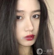 近聽(tīng)我的朋友說(shuō)，熱瑪吉特別的火，他是一個(gè)抗衰老的項(xiàng)目