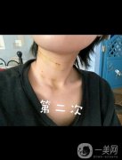 脖子真的就是女人的第二張臉，所以大家在保養(yǎng)自己臉蛋的同時(shí)，也不要忘記自