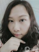 雙眼皮恢復(fù)這段時(shí)間我也收到了醫(yī)生很大的關(guān)懷，手術(shù)做的很快，大概不到兩個(gè)
