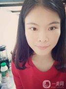 我覺(jué)得現(xiàn)在的眼睛還不如手術(shù)之前的單眼皮好看呢，正等我為自己更加難看的眼