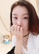 現(xiàn)在做完法令紋已經(jīng)有好幾年的時(shí)間了，依然會(huì)感覺(jué)很不錯(cuò)，是一個(gè)飽滿的狀態(tài)