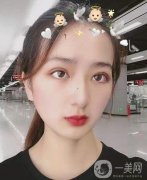 眼綜合手術已經(jīng)過去四個月的時間了，自從我做完手術之后，我?guī)ьI了我身邊的