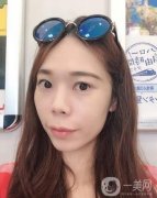 做完熱瑪吉項目已經(jīng)兩個月的時間了，近我還給醫(yī)生發(fā)去了我現(xiàn)在的照片
