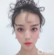 做完隆鼻手術(shù)已經(jīng)有一個(gè)月的時(shí)間了，身邊的朋友看到我都說(shuō)我的鼻子變好看了