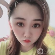 做完拉皮手術(shù)已經(jīng)有兩個月的時間了，大家看一下，我是不是有了大的變化