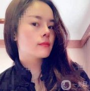 電波拉皮去頸紋第三天，并沒有感覺到不舒服，我現(xiàn)在只要一有時間就照鏡子