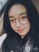 建議本人做一個玻尿酸除皺，當(dāng)時就下定決心做這個項(xiàng)目了