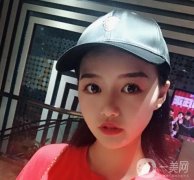 ，醫(yī)生也是認(rèn)真的分析了我臉上的問題，然后推薦我做一個玻尿酸除皺的項(xiàng)目