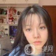 今天的雙眼皮還是有點(diǎn)腫，錄了下來