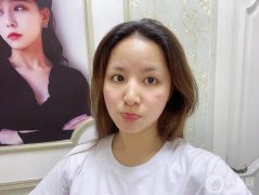 面部吸脂手術(shù)是一個(gè)純粹的微創(chuàng)手術(shù)所以在聽了醫(yī)生的建議后，我決定做面部吸