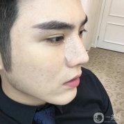 鼻子不好看經(jīng)過(guò)長(zhǎng)時(shí)間的心里斗爭(zhēng)，終我下定決心改變自己