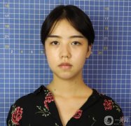 鼻子拆線了,恢復(fù)得很好,形狀也已經(jīng)出來(lái)了