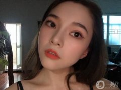 滿月打卡!30天恢復(fù)，鼻子還是很好的，鼻型和鼻腔的切口都很好，沒有異常不適