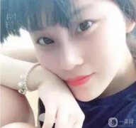 鼻子恢復(fù)得很快，沒有嚴(yán)重的腫脹期,現(xiàn)在很喜歡我的鼻子形狀
