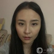 拉完皮也沒有出現(xiàn)那凹凸不平的現(xiàn)象，真的是越來(lái)越了
