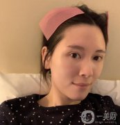 做完熱瑪吉，臉部的整體輪廓特別的明顯