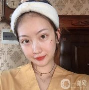 做完熱瑪吉之后，皮膚變得的緊致，滿臉的膠原蛋白