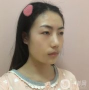 熱瑪吉這個項目真的是特別的神奇，皮膚是越來越穩(wěn)固